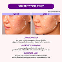 Load image into Gallery viewer, 10% Niacinamide &amp; 1.9% Salicylic Acid Oil Control Serum